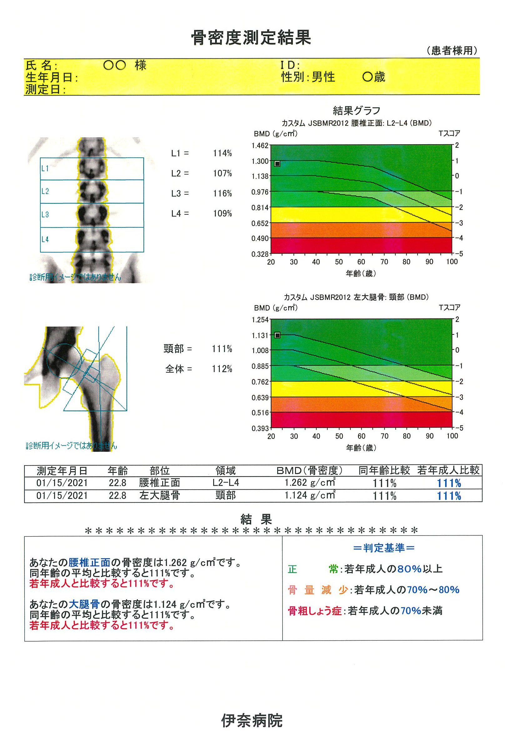 骨密度検査結果